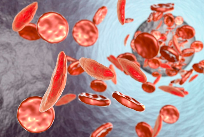 Best Clinic for High Fever Treatment | Fever Clinic: Navdisha Medicare